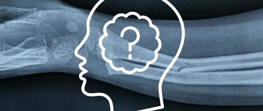 The Broken Bone Theory